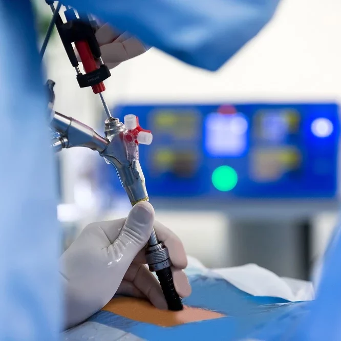 About Endovascular Surgeon