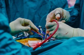 Vascular surgeon in Dubai